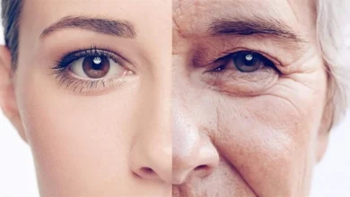 ضغوط الجمال على النساء